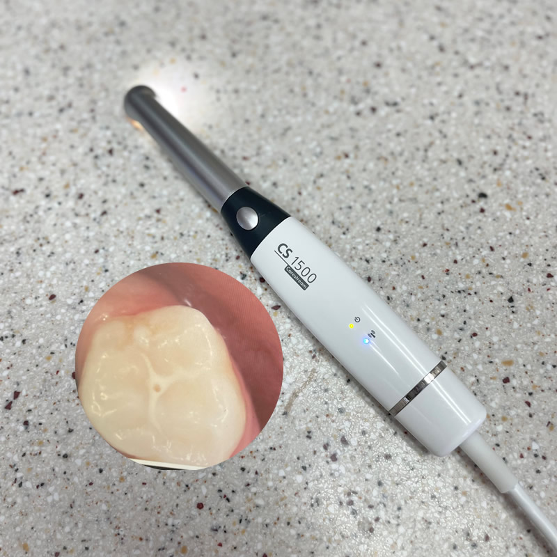 Intra-oral camera used to show patients real-time images of their teeth